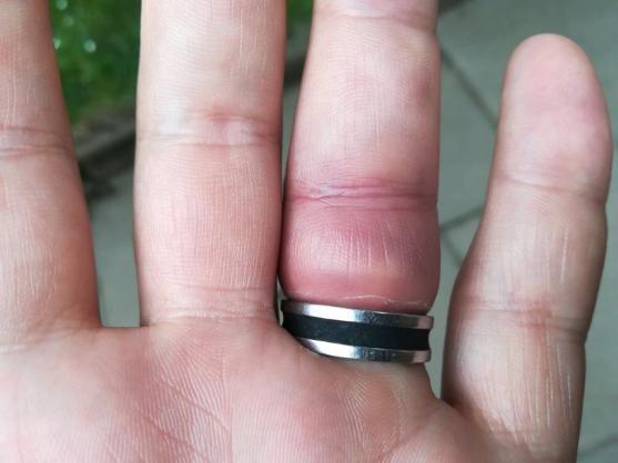 I toto je práce hasičů