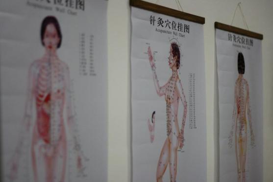 Tradiční čínská medicína léčí i závislosti. Medichina otevřela ve Velichovkách