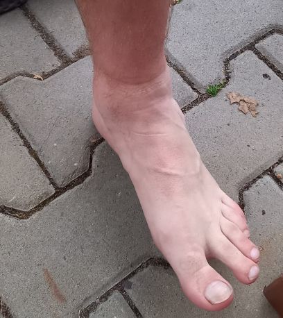 I přes rychlá zranění hráčů Broumov slaví první vítězství v sezóně