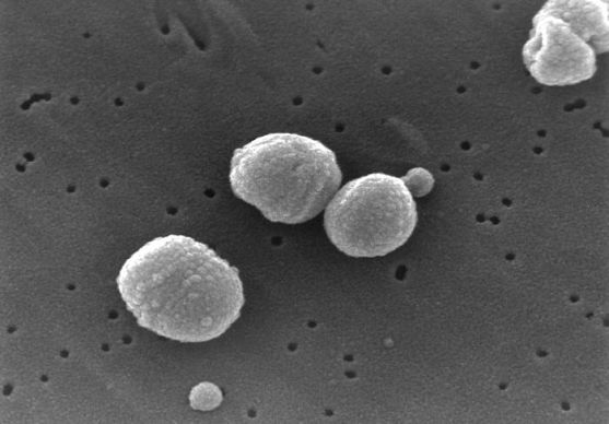 Krajská hygienická stanice má od začátku roku hlášeno již 13 případů nákaz pneumokokovou bakterií
